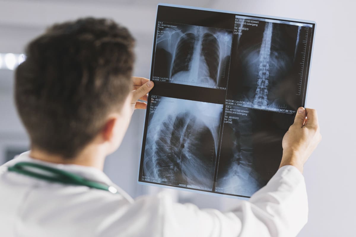 Rayos X en Clínica Hispana